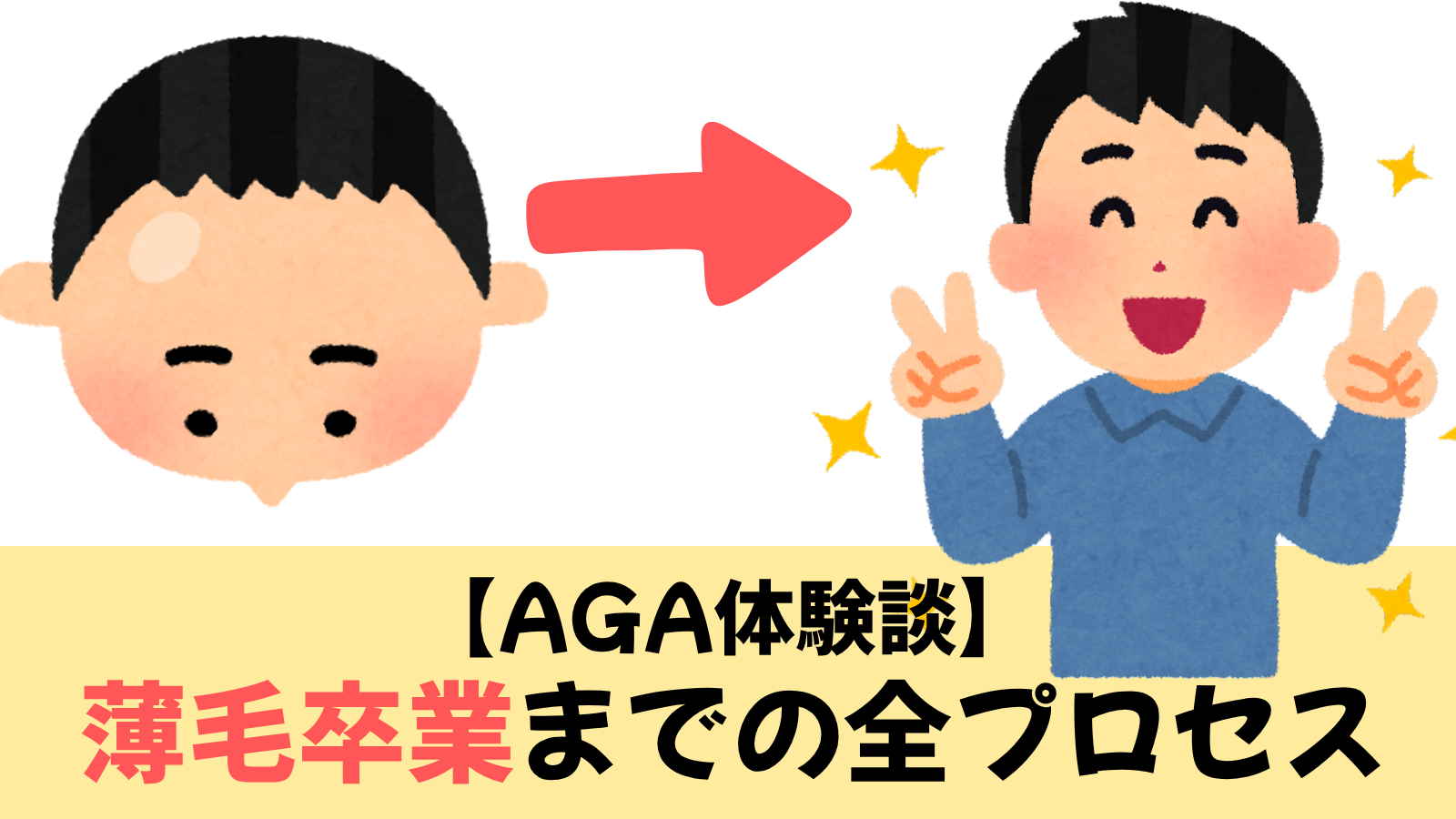 【実録!AGA治療体験談】わずか3ヶ月で発毛!薄毛卒業までの全プロセス